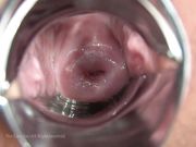 屈辱羞耻クスコなって特集